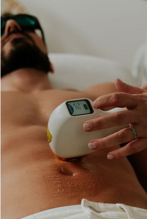 visuel : Surfeurs, cyclistes, nageurs : pourquoi passer au laser